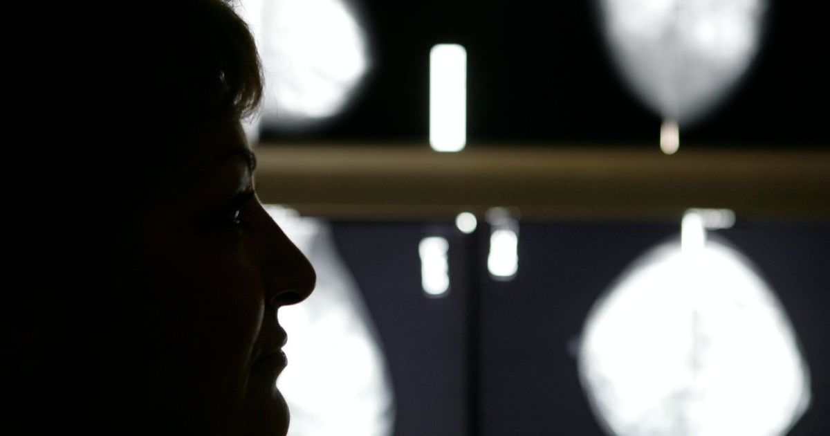 US Committee: Breast Cancer Investigation must start at the age of forty