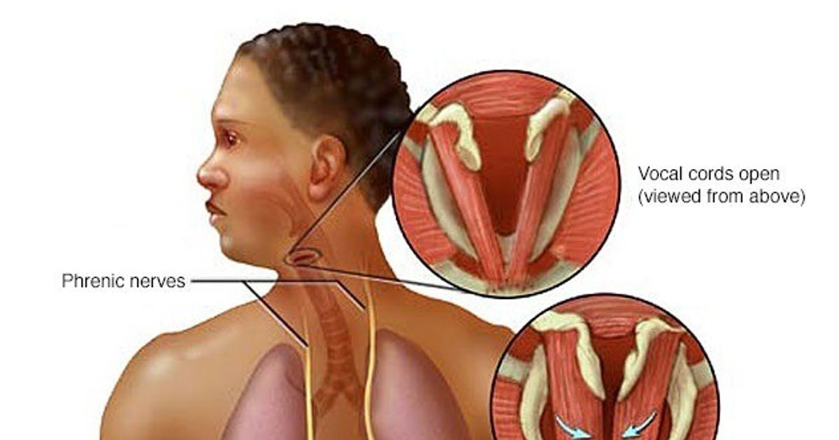 Higge spasms .. your guide to eating and healthy habits to avoid annoying symptoms
