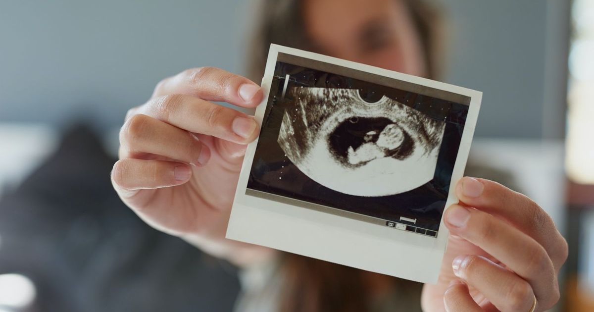 Double uterus … a rare condition that threatens pregnancy