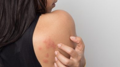 Urendis: symptoms, causes and treatment