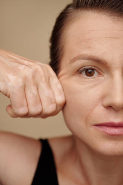 How to keep your skin tight