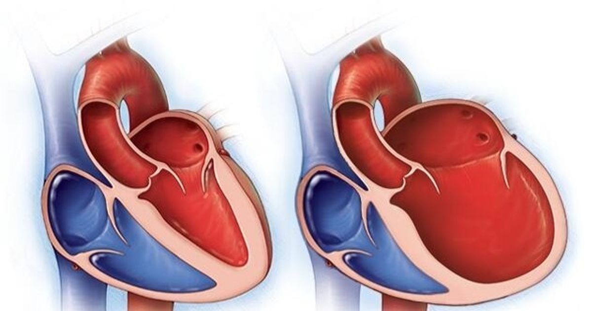 Evangelical fucking in the heart .. causes, symptoms and treatment