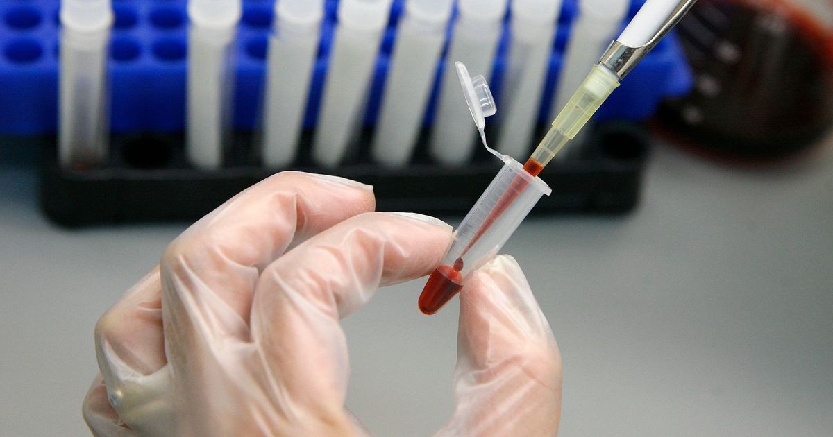 Genetic drugs “Hope Road” for patients suffering from sickle cell anemia
