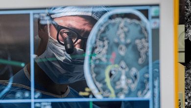 America .. Researchers manage to reduce the size of the brain tumors with T -cells