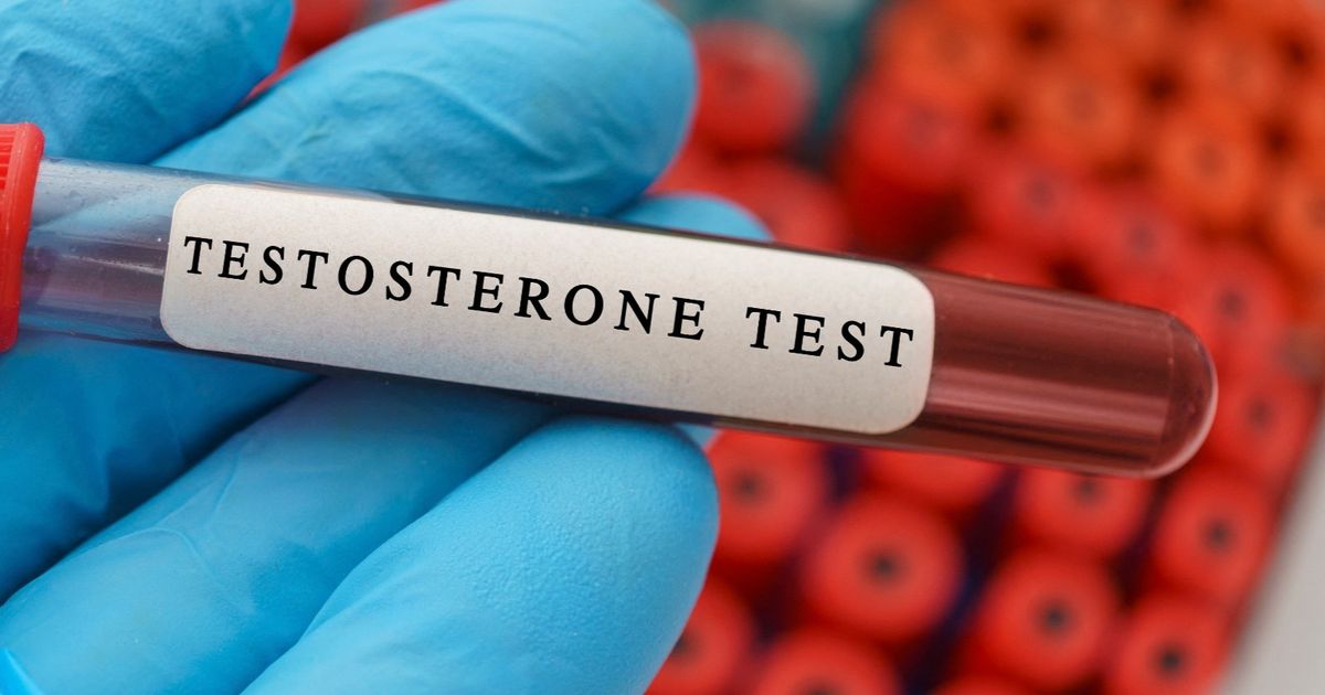 Testosterone deficiency .. What is the insufficiency of male gender glands?