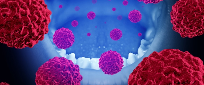 Oral cancer: causes, symptoms and treatment