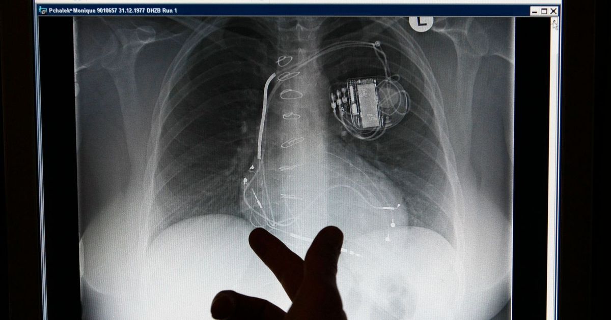Heart failure .. symptoms, causes and advice for prevention
