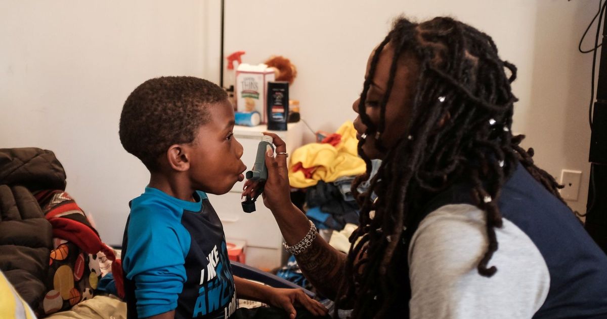 The rare “Sherg Strauss” syndrome .. sought “asthma”