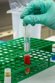 Take care of health with 5 health tests