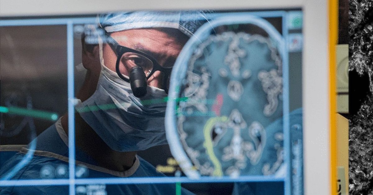 Epilepsy surgery .. option after medicine does not relieve nubia