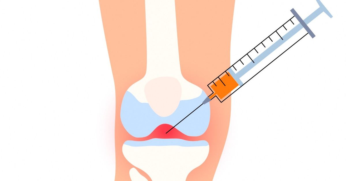 Psoriasis arthritis … symptoms, causes and treatment