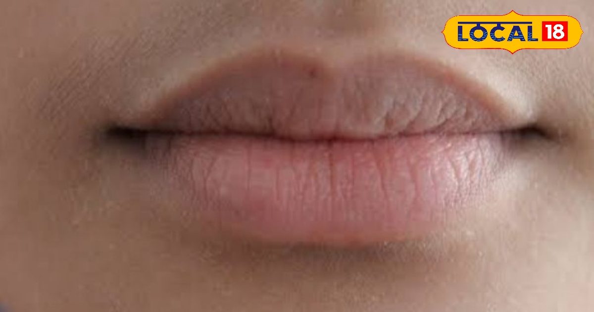 Red, yellow or purple! Change your lips colors, so be careful; There are signs of these dangerous diseases
