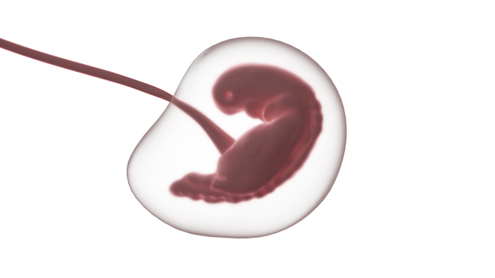 Shocking mixing! Woman gives birth to the baby of stranger after fertility implant incorrect embryo | Today news