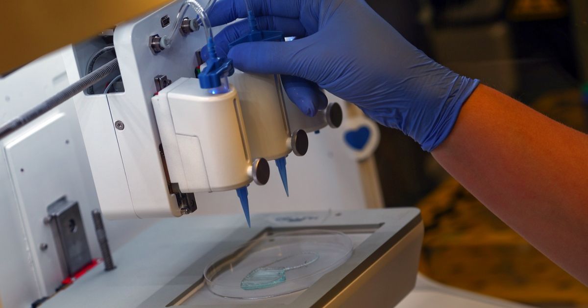 Kidney lamp inflammation .. What do we know about its disease and its complications?