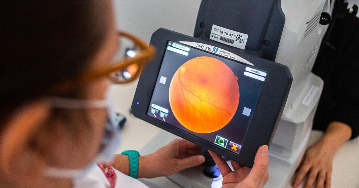 Nat macular degeneration attacks the eye … symptoms, causes and treatment