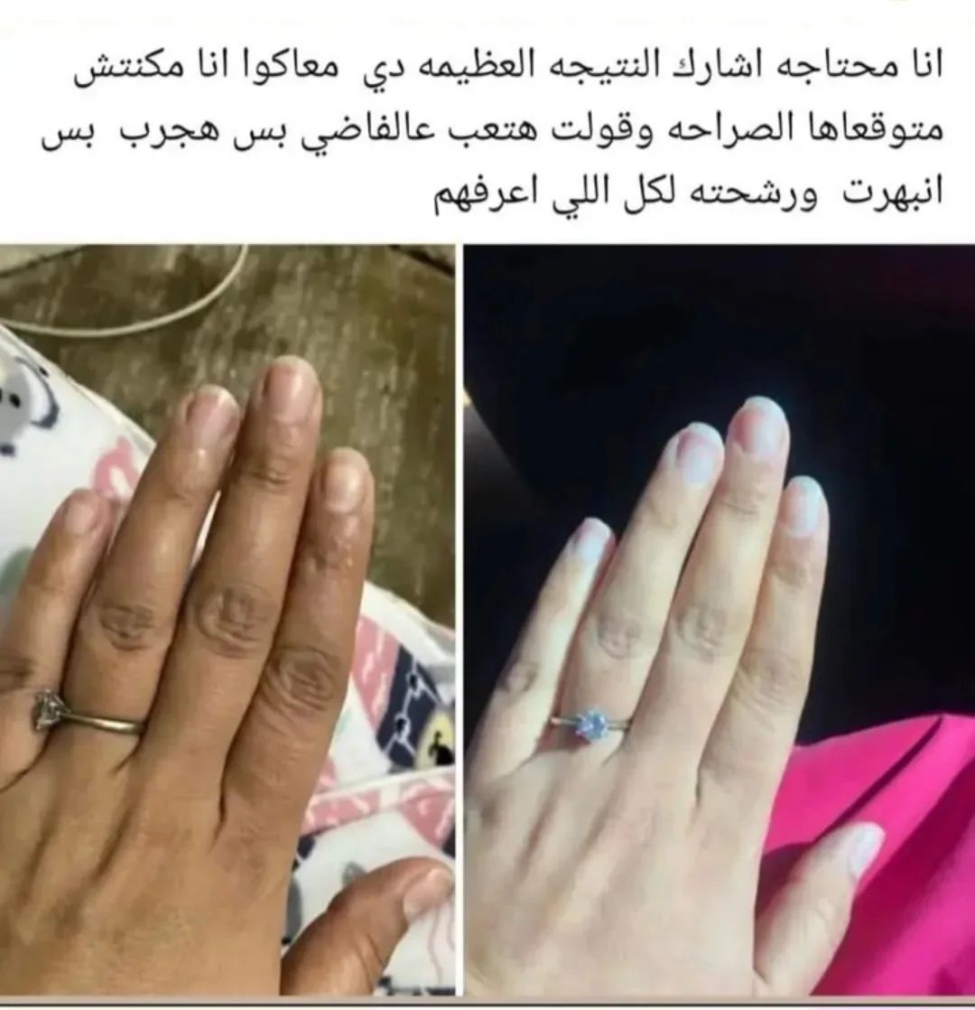 ⁩التجربة خير دليل شوفو تجارب زبايني بحسابي اطلبوها الآن والنتيجة مضمونة خلطة ا… – ryan