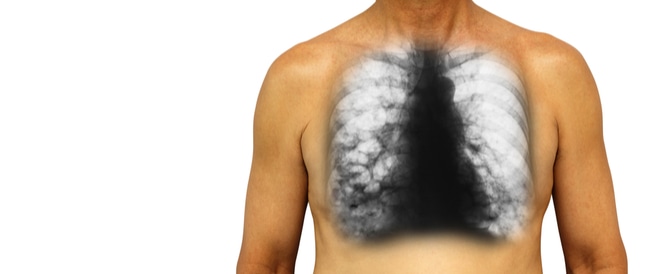 Rumper inflammation: symptoms, causes and treatment