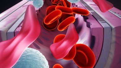 Aplastic anemia .. symptoms, causes and prevention