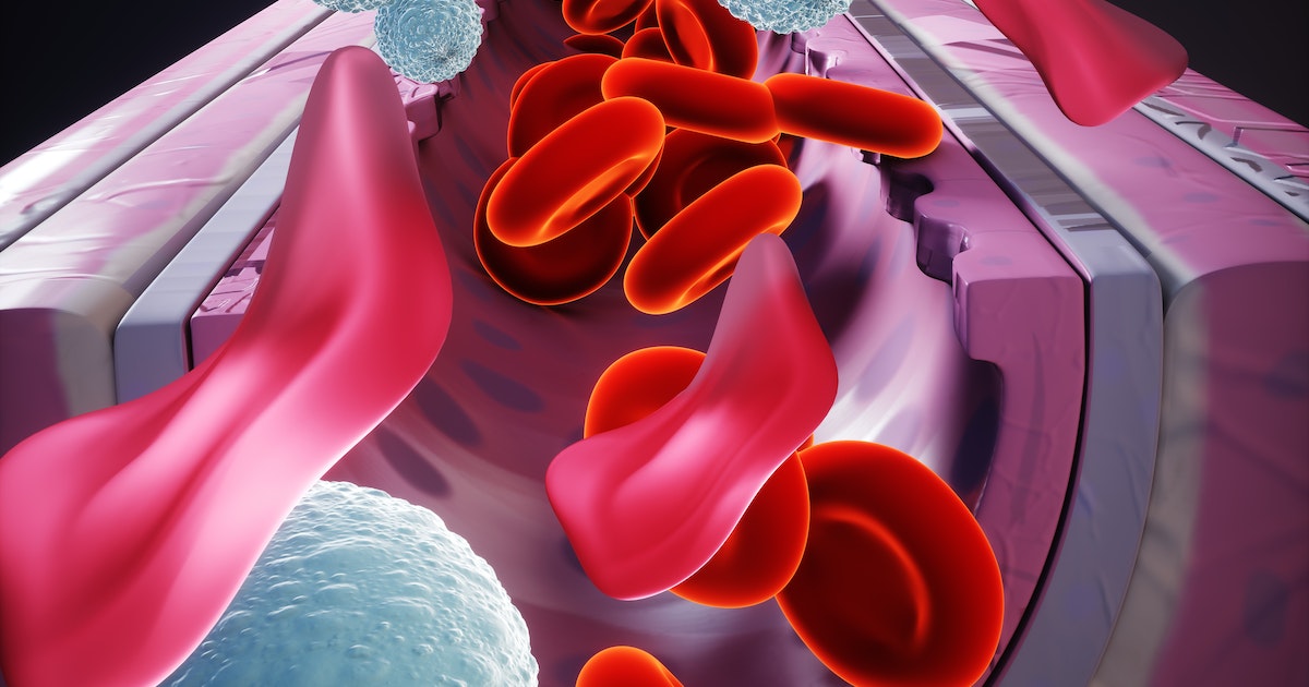 Aplastic anemia .. symptoms, causes and prevention