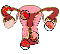 Trouble of sexual intercourse: Causes, symptoms and treatment.