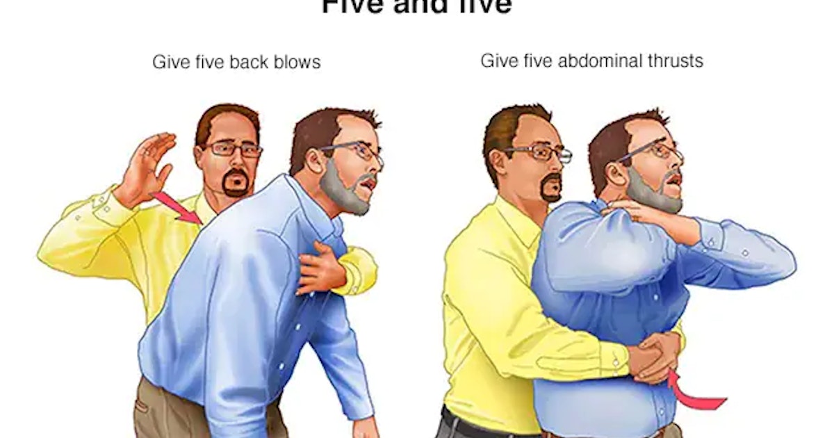 4 First Aid in case of a strange body inhalation