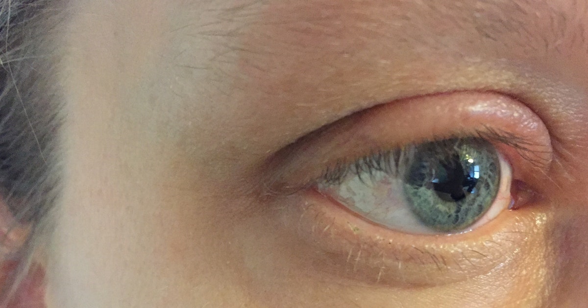 Eye shadow .. madness affects most people. What is the reason?