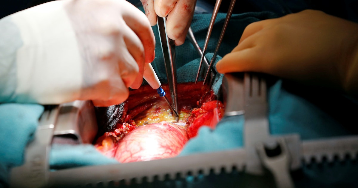 One of the most common causes of sudden death. Learn about the stomach fibrillation