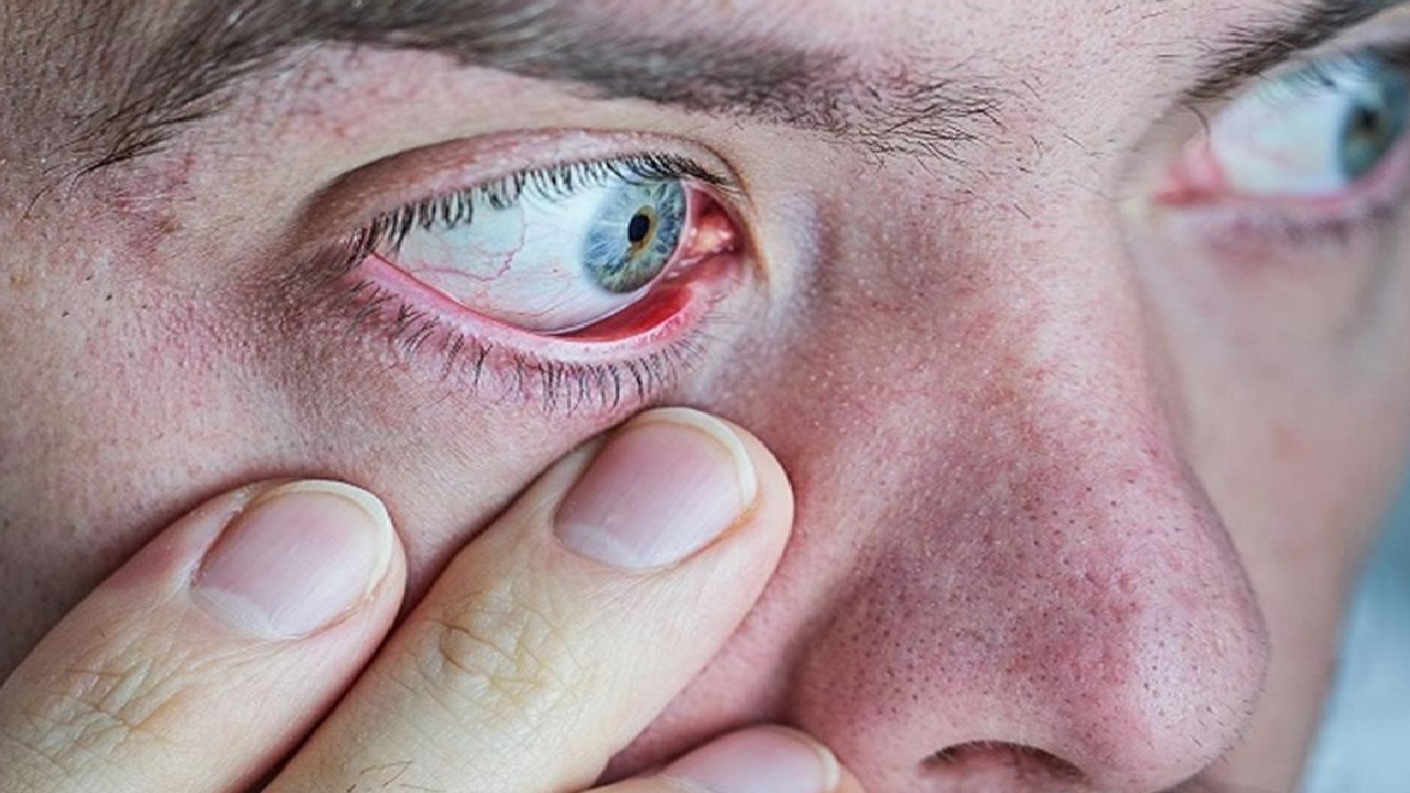 Eye signs reveal early symptoms of dementia – ryan