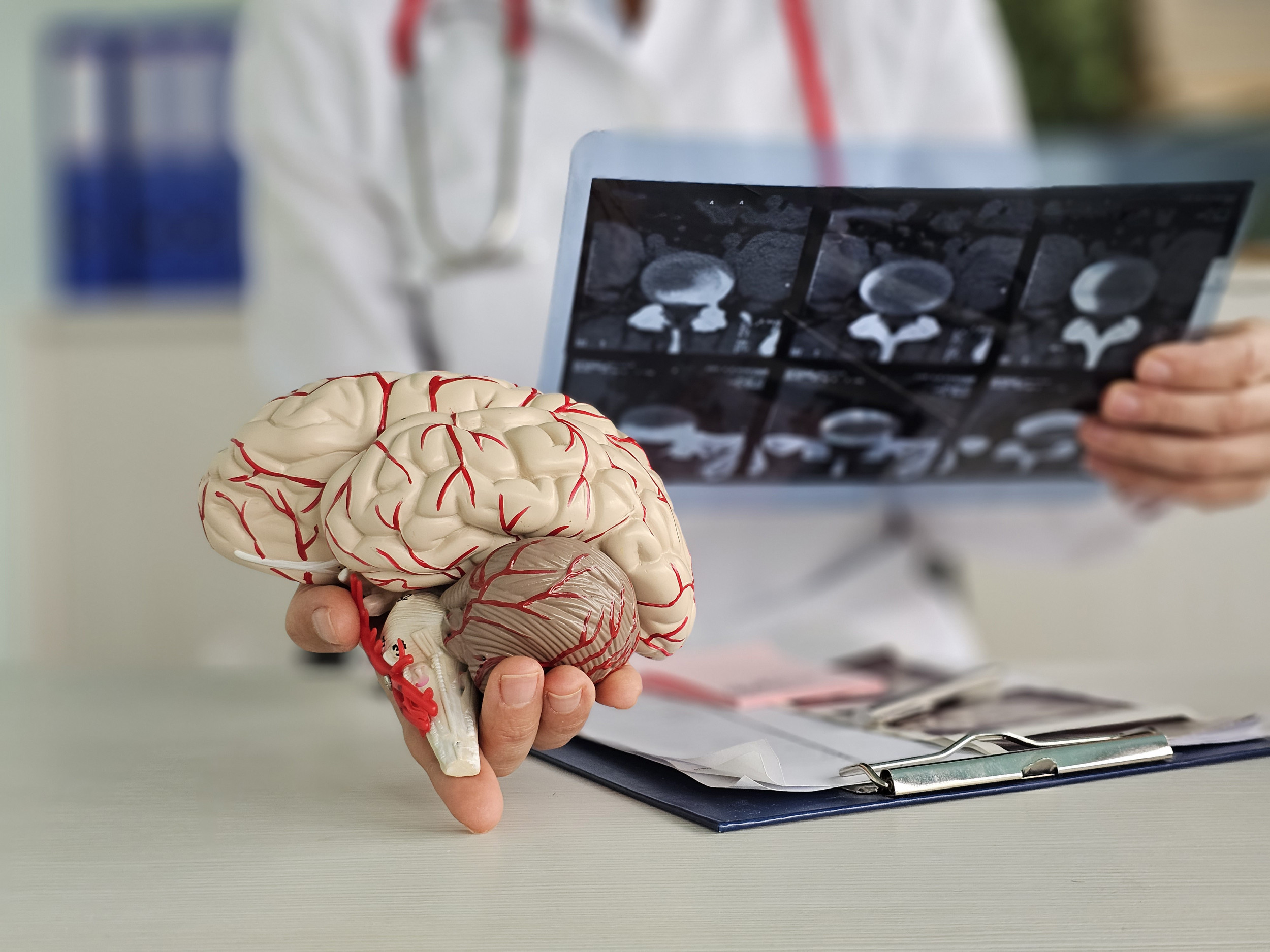 ‘Remarkable’ ALS Drug May Also Work on Alzheimer’s – ryan
