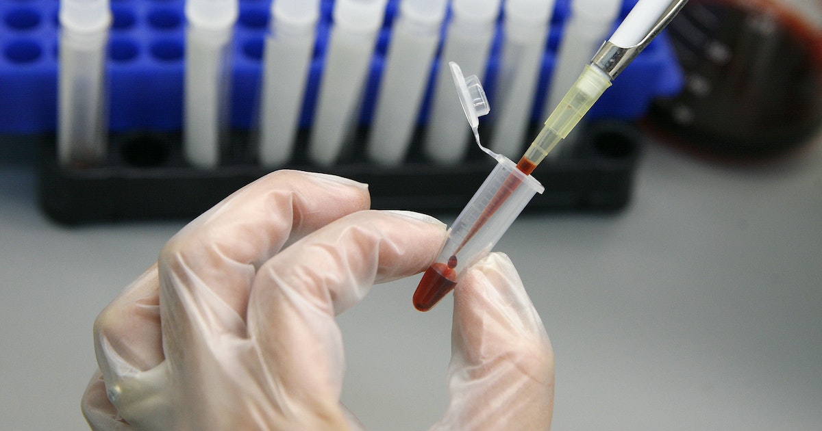 4 questions and answers about the full blood census examination