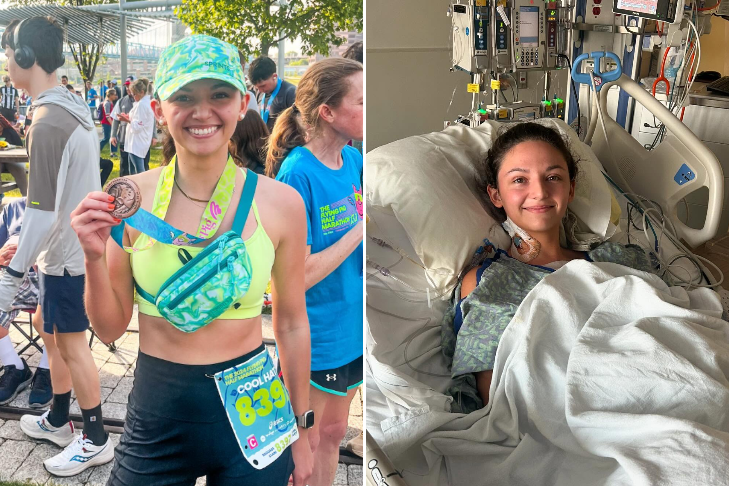 Marathon Runner Who Felt Breathless Finds Out She Has Heart Failure at 24 – ryan