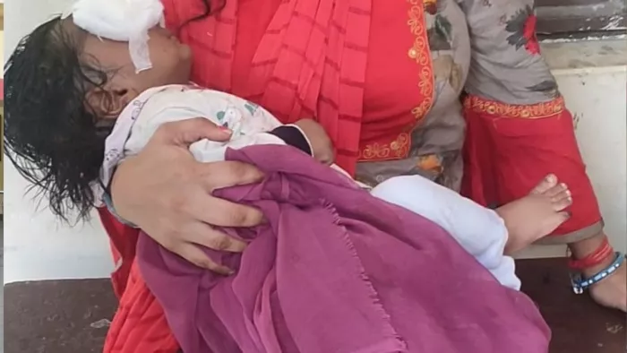 KASGANJ NEWS: Spiritual patient pierced the pen in the eyes of a six -month -old child, Aligarh refers to the state of the condition -Pen attack 6 -month -old baby injured in eye attack by mentally ill cousin