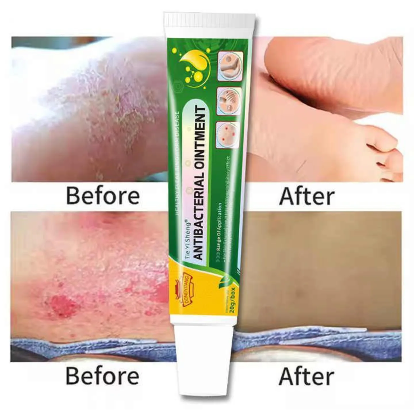 Tie Yi ShengⓇ
HEALTHY CLEAR RINGWORM DISEASE  ANTIBACTERIAL OINTMENT
كريم مخصص ع… – ryan