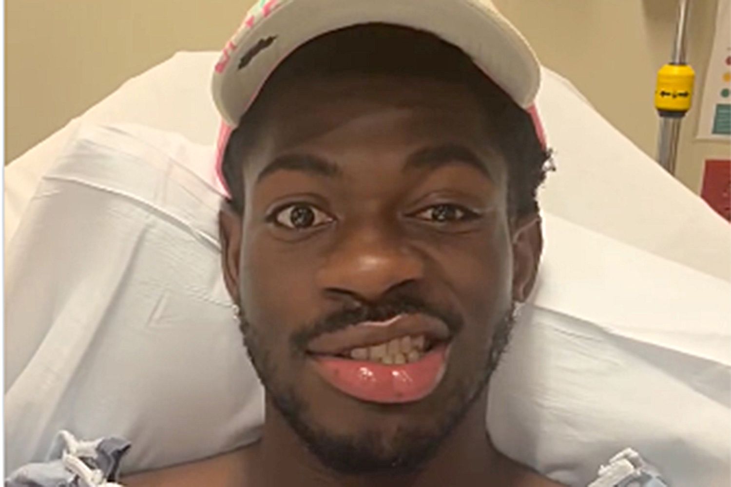 Lil Nas X Says He ‘Lost Control of the Right Side of My Face’ – ryan