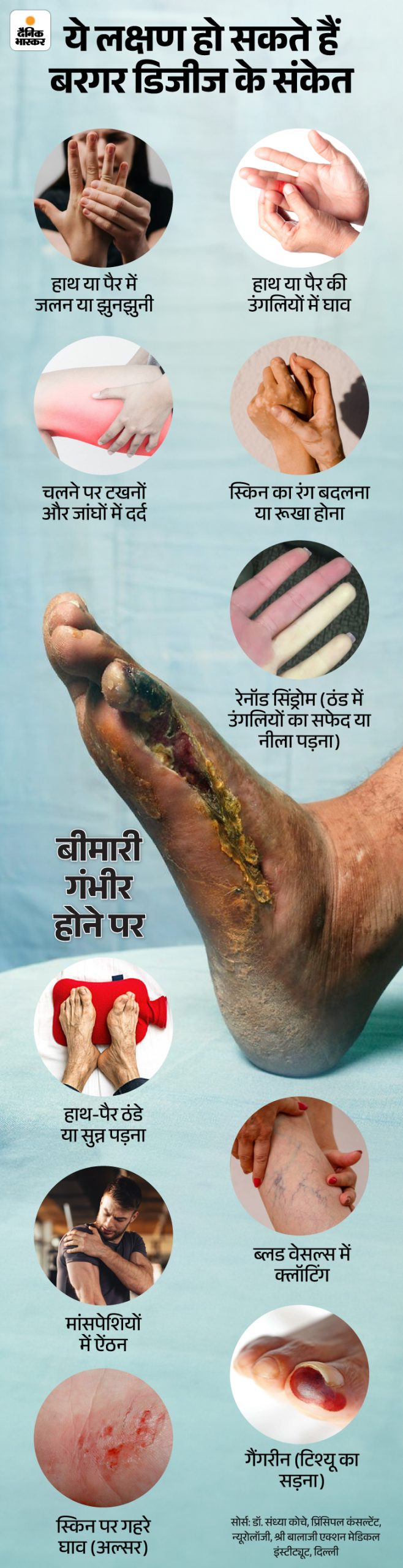 Buerger Disease Symptoms (Skin Color Change) | Cigarette Smoking | Sehtanama