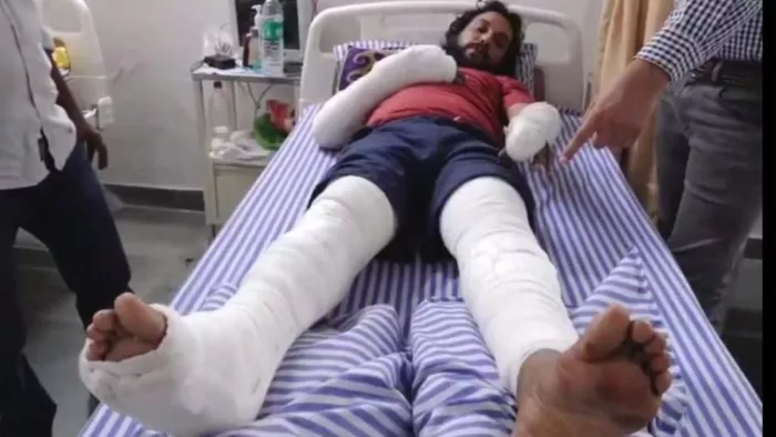 Video: Girlfriends showed a terrible form to refuse to get married, name Goons, and broke the hands and feet of boyfriends; Read poor Majra – Woman broke her lover hands and legs when he refused to marry her in Faridabad