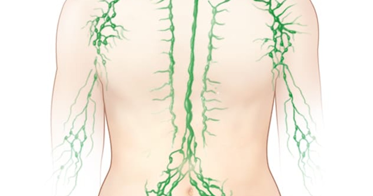It is caused by a viral or bacterial infection. What do you know about the swelling of the lymph nodes?
