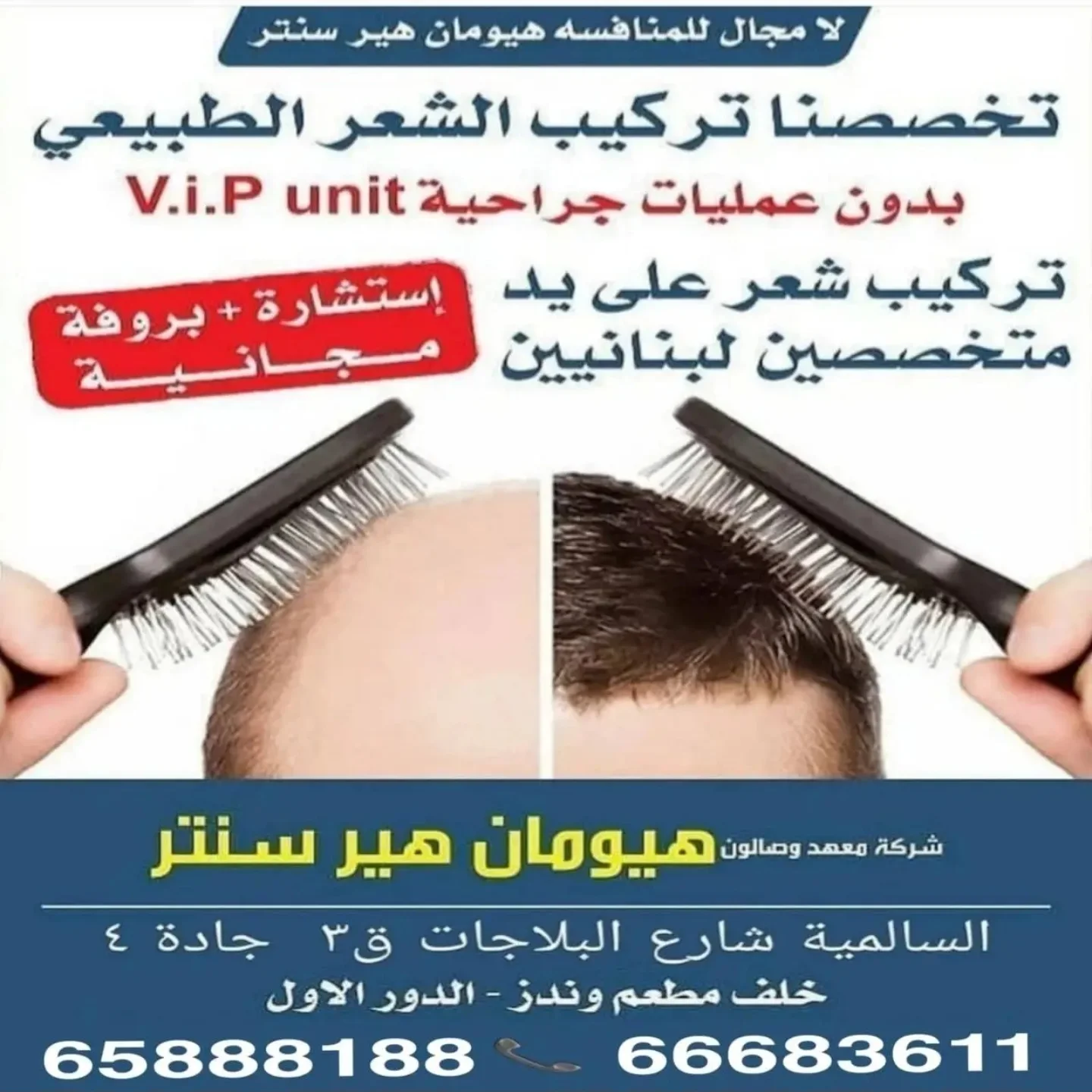 هل جاهز للتغيير؟؟؟ نحن بأنتظارك اختار هيومان هير سنتر افضل مكان للاختيار و… – ryan