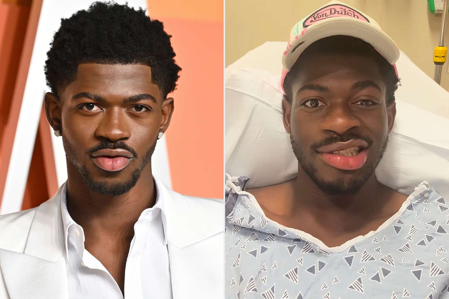 What Is Going On with Lil Nas X’s Face? All About the Rapper’s Facial Paralysis – ryan