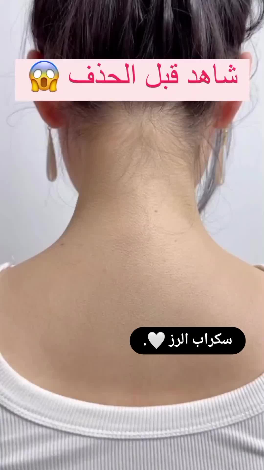سكراب الرز ينظف البشرة ويرطب وينطي نضارة عاليه . السعر 4,000 الاف فقط . . . . … – ryan