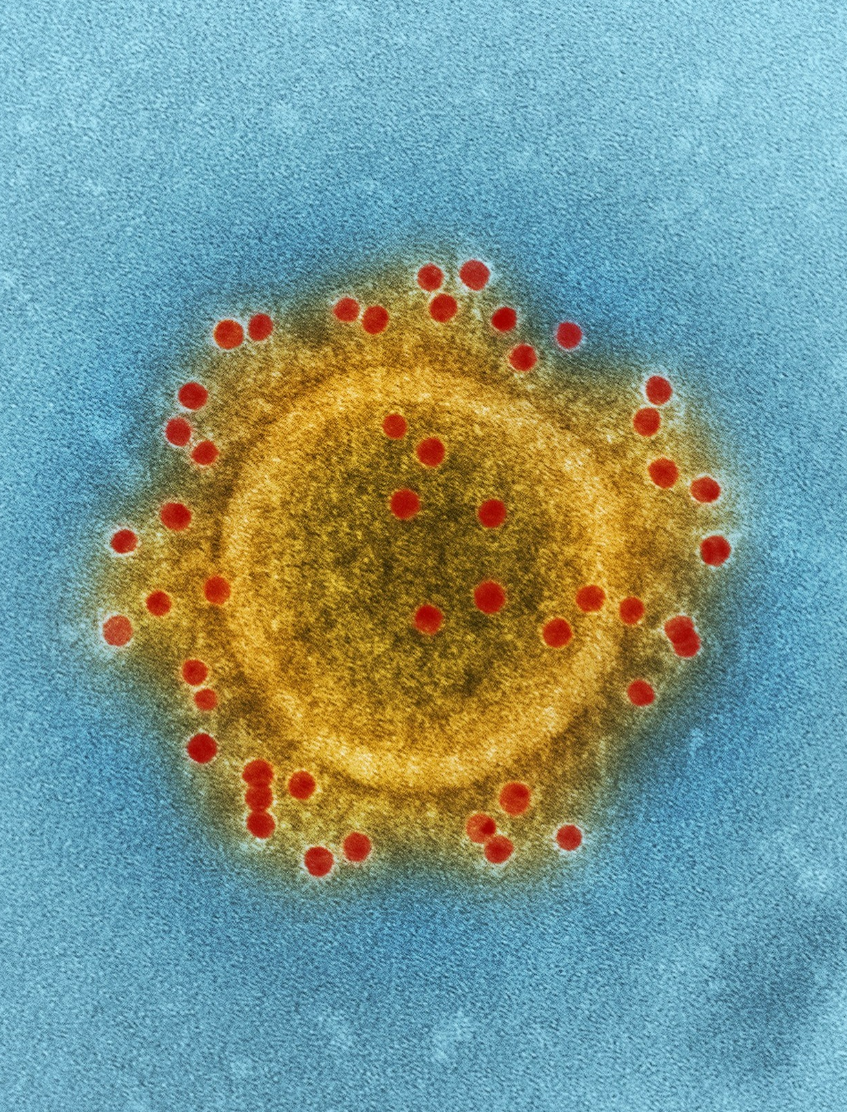World’s ten most dangerous viruses