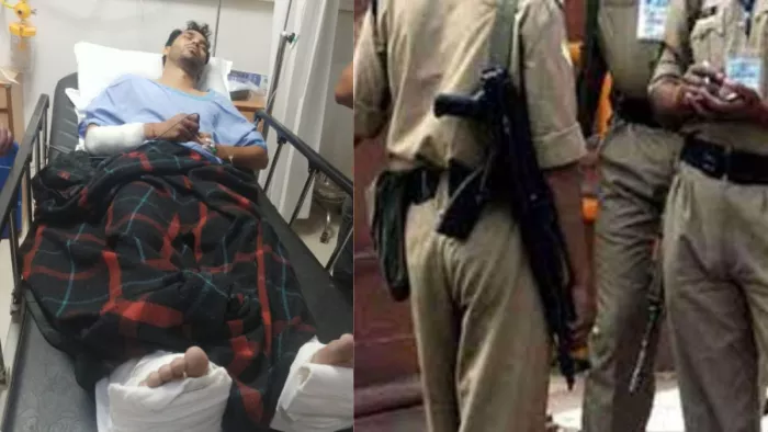 Faridabad News: The woman who broke her husband’s hands and feet is married on this day; Now the police … – Faridabad News fiancé breaks groms limbs with lover before the wedding