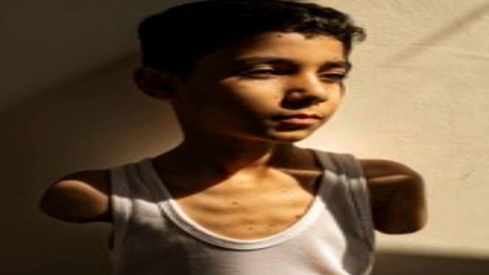 Award -winning photo puts the face of the Gaza war tragedy: a Palestinian boy with no arms | Today news