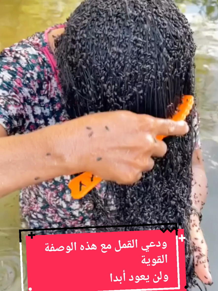 الوصفة التي ستخلصك من القمل نهائيا ولن يعود أبدا #وصفة #وصفات #وصفات_طبيعية #ق… – ryan