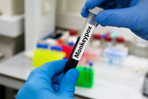 Second death confirmed by Mpox in Zambia, the case increased to 49