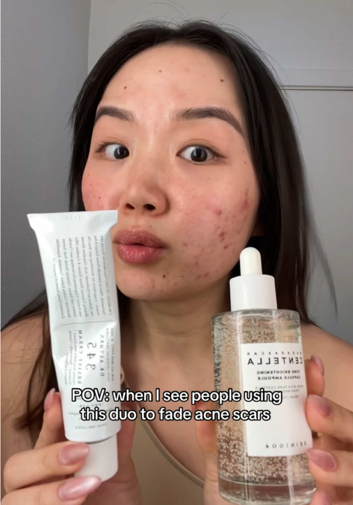 Your acne scars will thank you #acne #acneskincare #skin1004 #hyperpigmentati… – ryan