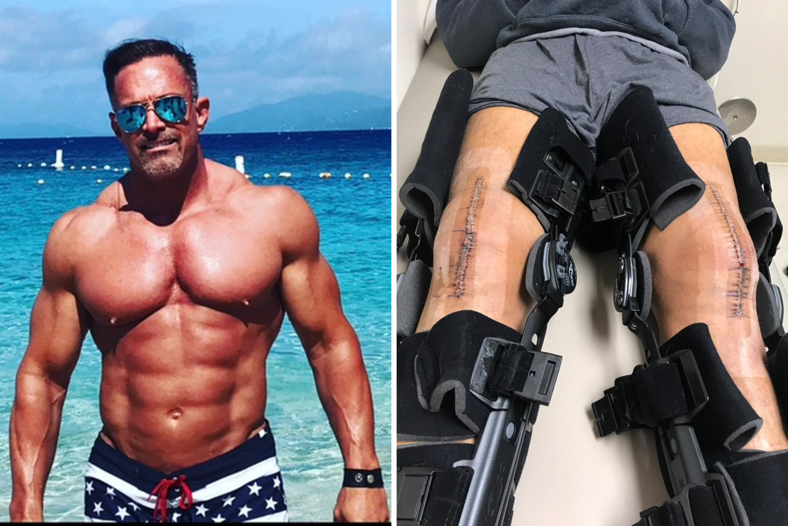I Was Doing Squats in the Gym, Then My Life Changed in an Instant – ryan