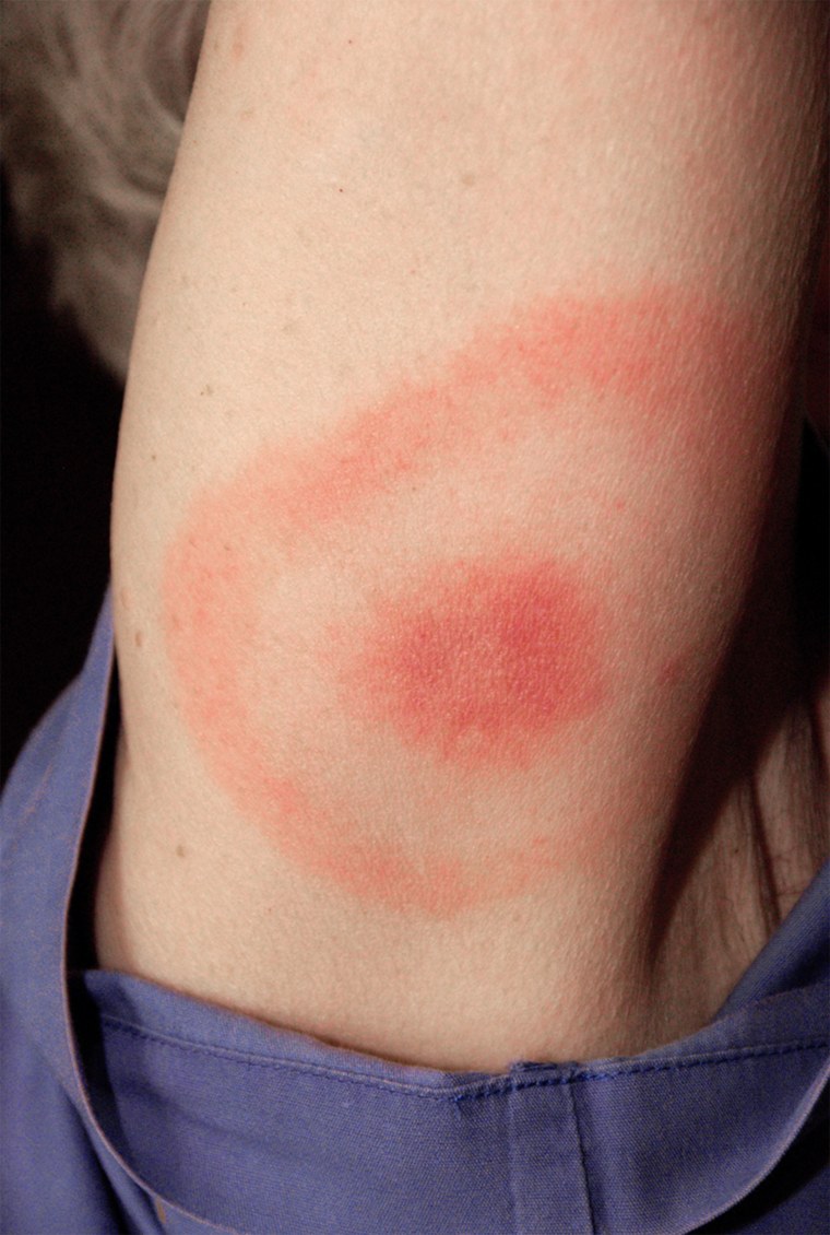 Should you see a doctor for that skin rash? Experts share advice and home treatments – ryan