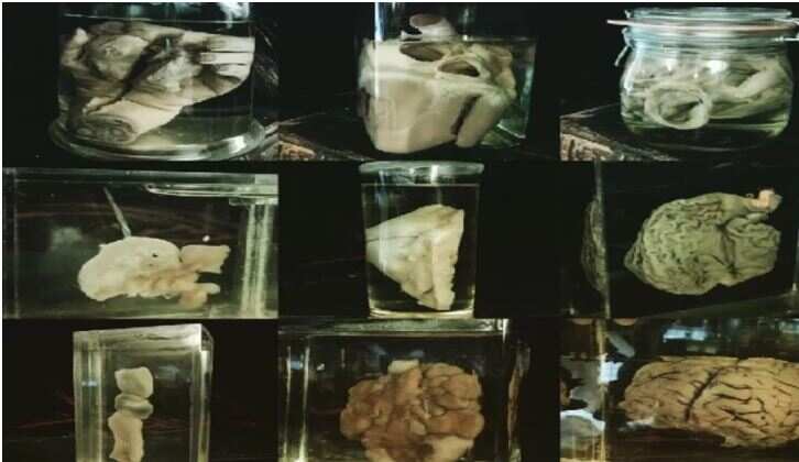 This person sells pickles of human organs, people scream to see it