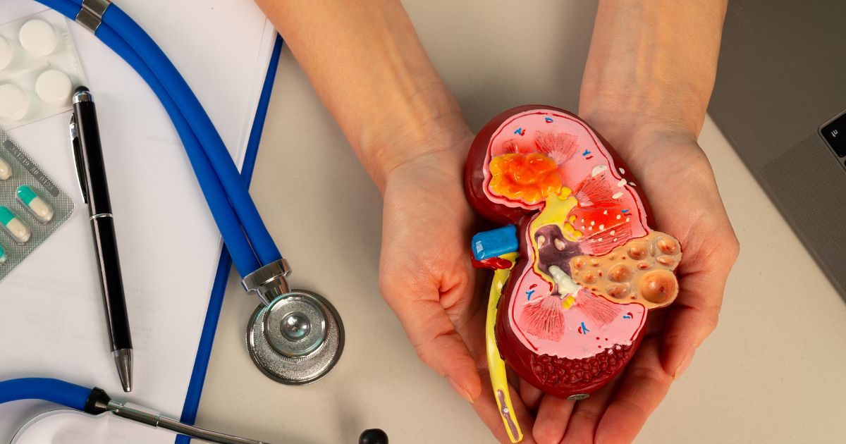 These 5 cheap things make the kidney strong! If you have included in the diet, it will stay healthy!